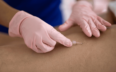 Carbossiterapia: una terapia innovativa per migliorare il microcircolo veno-linfatico